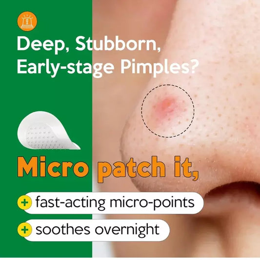 Troubless Micro-Point Patch Plus Limited Value Pack