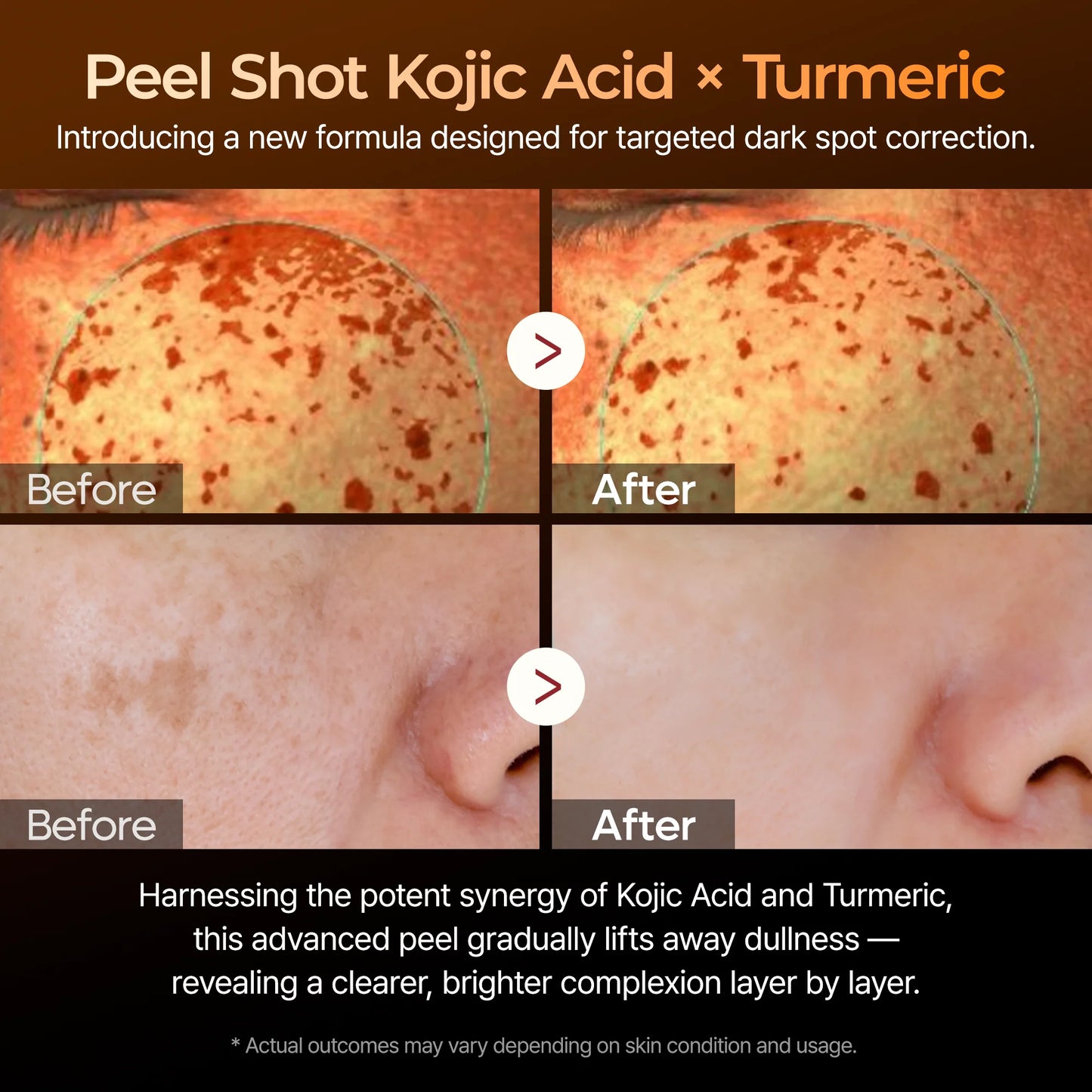 Dr. Melaxin Peel Shot Kojic Acid Turmeric Serum