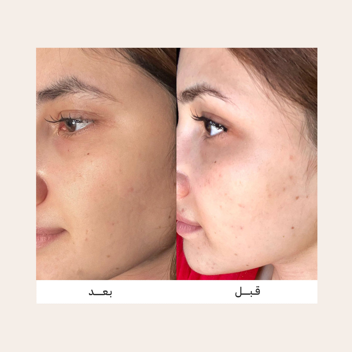 Vivian Active Capsules Dark Spot & Brightening Serum