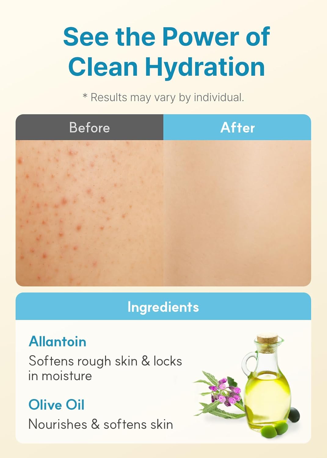 DERMA:B Daily Moisture Body Lotion