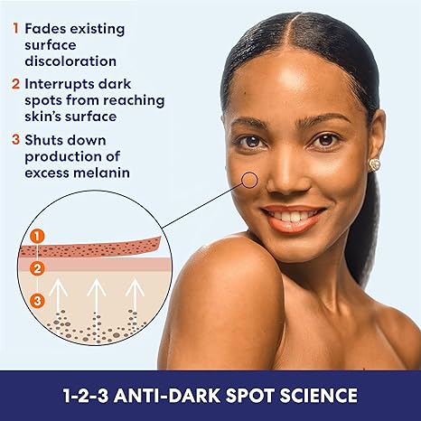 Palmer’s Skin Success Anti-Dark Spot Fade Milk Body Lotion for Dry, Uneven Skin