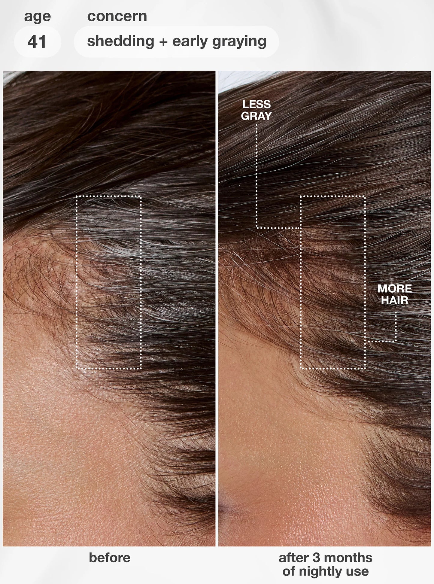K18 Future IO™ Biomimetic Hair Longevity Serum