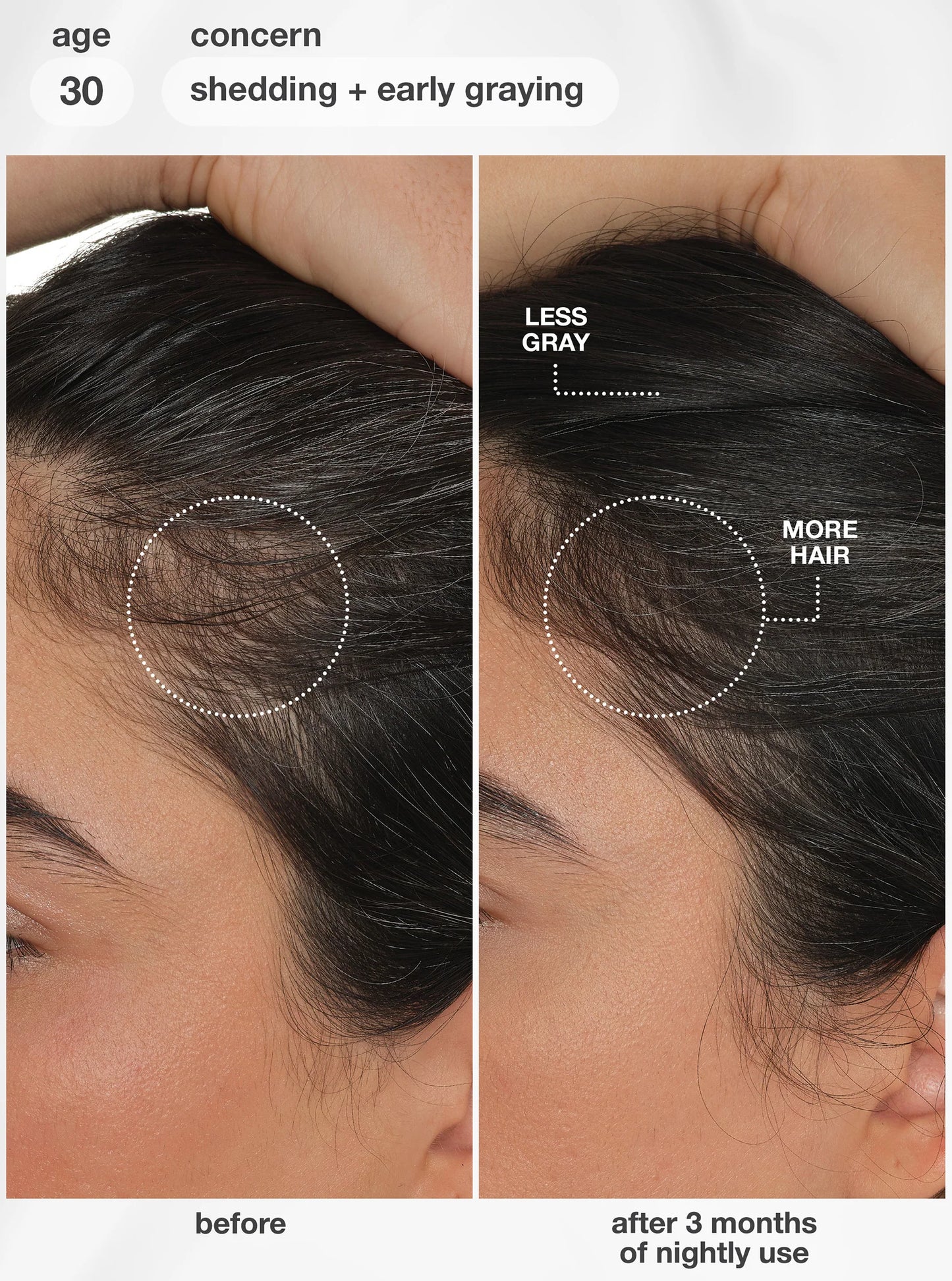 K18 Future IO™ Biomimetic Hair Longevity Serum