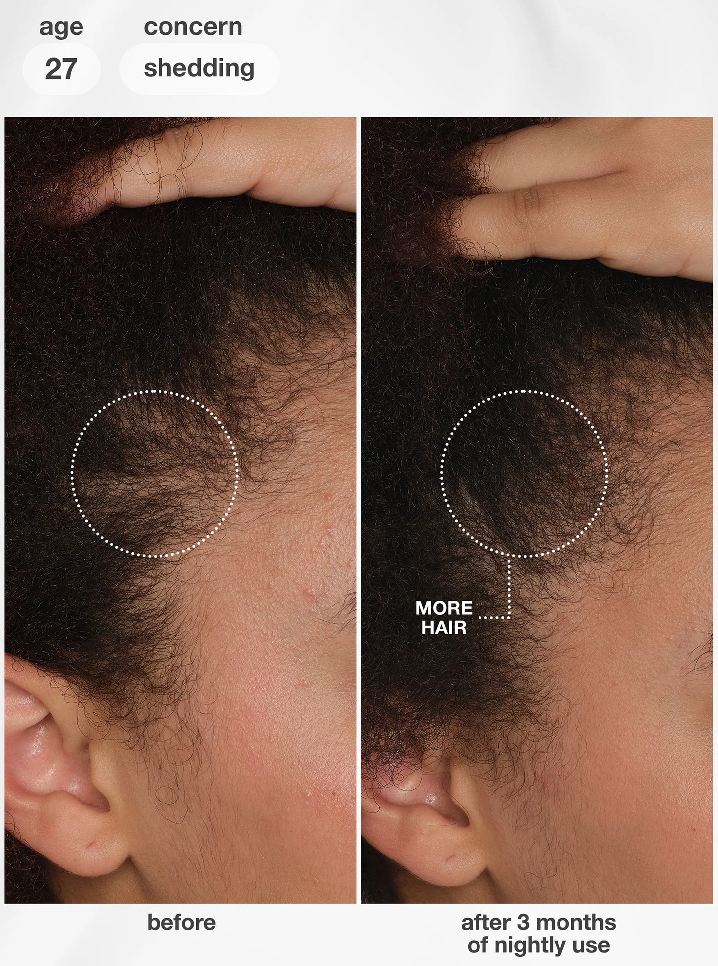 K18 Future IO™ Biomimetic Hair Longevity Serum