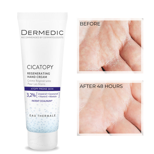 Dermedic Regenist Regenerating Hand Cream
