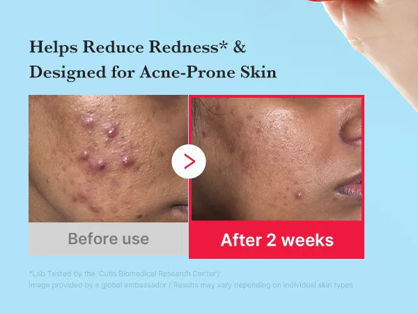 Medicube Hypochlorous Acid Daily Facial Spray