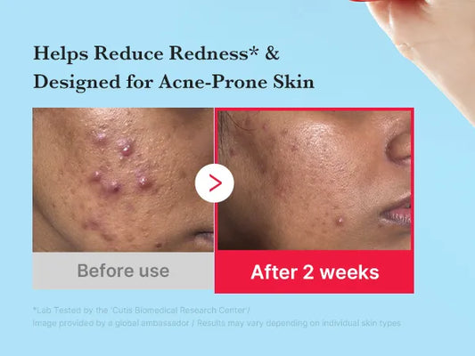 Medicube Hypochlorous Acid Daily Facial Spray