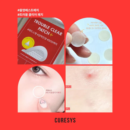 CURESYS Trouble Clear Needle Patch