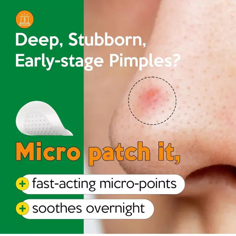 Troubless Micro-Point Patch Plus Limited Value Pack
